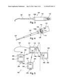 ACTIVE IMPLANTABLE MEDICAL DEVICE COMPRISING A CONNECTOR-FREE CAPSULE,     PERMANENTLY CONNECTED TO A MICROLEAD diagram and image