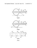 CARBON MONOXIDE POISONING RESOLVING DEVICE, JACKET FOR CARBON MONOXIDE     POISONING TREATMENT HAVING THE DEVICE, AND CATHETHER FOR CARBON MONOXIDE     POISONING TREATMENT diagram and image