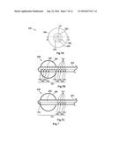 CARBON MONOXIDE POISONING RESOLVING DEVICE, JACKET FOR CARBON MONOXIDE     POISONING TREATMENT HAVING THE DEVICE, AND CATHETHER FOR CARBON MONOXIDE     POISONING TREATMENT diagram and image