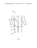 THERAPEUTIC LIGHT ENABLED TOILET AND METHODS FOR OPERATING A THERAPEUTIC     LIGHT SOURCE diagram and image