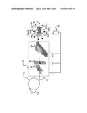 Method for Irradiation Planning diagram and image