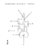 TENSIONING ELEMENT FOR TENSIONING A JUMPING MAT ON A FRAME OF A TRAMPOLINE diagram and image