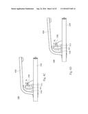 STEPPER diagram and image