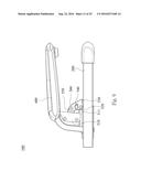 STEPPER diagram and image