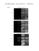 EPITHELIAL-MESENCHYMAL TRANSITION IN CIRCULATING TUMOR CELLS (CTCS)     NEGATIVES FOR CYTOKERATIN (CK) EXPRESSION IN PATIENTS WITH NON-METASTATIC     BREAST CANCER diagram and image