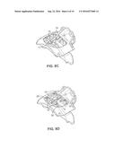 Disc brake pad retention system and mounting method diagram and image