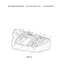 Disc brake pad retention system and mounting method diagram and image