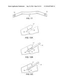 Disc brake pad retention system and mounting method diagram and image