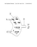 GEAR UNIT HAVING A HOUSING diagram and image