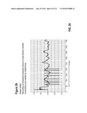 Method and System for Diagnosing Uterine Contraction Levels Using Image     Analysis diagram and image