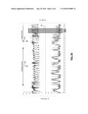 EEG MONITOR OF FETAL HEALTH diagram and image