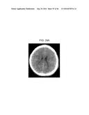 METHODS AND KITS FOR ASSESSING NEUROLOGICAL AND OPHTHALMIC FUNCTION AND     LOCALIZING NEUROLOGICAL LESIONS diagram and image