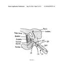 Endorectal Prostate Probe Composed Of A Combined Mini Gamma Camera And     Ultrasound Sensor diagram and image