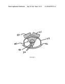 Endorectal Prostate Probe Composed Of A Combined Mini Gamma Camera And     Ultrasound Sensor diagram and image