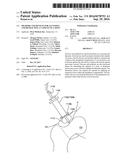 METHODS AND DEVICES FOR ACCESSING AND RETRACTING A CAPSULE OF A JOINT diagram and image