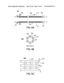 METHODS AND DEVICES FOR ACCESSING AND RETRACTING A CAPSULE OF A JOINT diagram and image