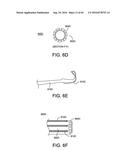 METHODS AND DEVICES FOR ACCESSING AND RETRACTING A CAPSULE OF A JOINT diagram and image