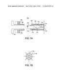 METHODS AND DEVICES FOR ACCESSING AND RETRACTING A CAPSULE OF A JOINT diagram and image