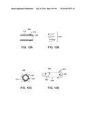 METHODS AND DEVICES FOR ACCESSING AND RETRACTING A CAPSULE OF A JOINT diagram and image