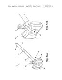 METHODS AND DEVICES FOR ACCESSING AND RETRACTING A CAPSULE OF A JOINT diagram and image