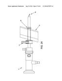 METHODS AND DEVICES FOR ACCESSING AND RETRACTING A CAPSULE OF A JOINT diagram and image