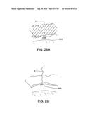 METHODS AND DEVICES FOR ACCESSING AND RETRACTING A CAPSULE OF A JOINT diagram and image