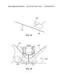 METHODS AND DEVICES FOR ACCESSING AND RETRACTING A CAPSULE OF A JOINT diagram and image