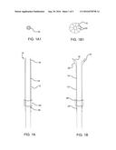 ENDOSCOPIC SOFT TISSUE WORKING SPACE CREATION diagram and image