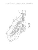 SURGICAL STAPLE BUTTRESS WITH INTEGRAL ADHESIVE FOR RELEASABLY ATTACHING     TO A SURGICAL STAPLER diagram and image