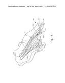 MALLEABLE BIOABSORBABLE POLYMER ADHESIVE FOR RELEASABLY ATTACHING A STAPLE     BUTTRESS TO A SURGICAL STAPLER diagram and image