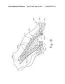 LOW GLASS TRANSITION TEMPERATURE BIOABSORBABLE POLYMER ADHESIVE FOR     RELEASABLY ATTACHING A STAPLE BUTTRESS TO A SURGICAL STAPLER diagram and image