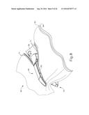 BIOLOGICALLY DERIVED EXTRACELLULAR MATRIX WITH INFUSED VISCOUS ABSORBABLE     COPOLYMER FOR RELEASABLY ATTACHING A STAPLE BUTTRESS TO A SURGICAL     STAPLER diagram and image