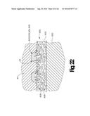 BIOLOGICALLY DERIVED EXTRACELLULAR MATRIX WITH INFUSED VISCOUS ABSORBABLE     COPOLYMER FOR RELEASABLY ATTACHING A STAPLE BUTTRESS TO A SURGICAL     STAPLER diagram and image