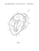 DEVICES AND METHODS FOR LEFT ATRIAL APPENDAGE CLOSURE diagram and image