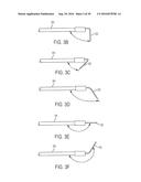 DEVICES AND METHODS FOR LEFT ATRIAL APPENDAGE CLOSURE diagram and image