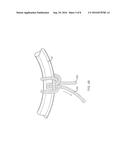 EMBOLIC COIL DELIVERY SYSTEM WITH EASY-RELEASE KNOT diagram and image