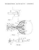 MEDICAL DEVICE FOR MODIFICATION OF LEFT ATRIAL APPENDAGE AND RELATED     SYSTEMS AND METHODS diagram and image