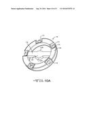 BONE CUTTER FOR CREATING HEMISPHERICAL CAVITIES diagram and image