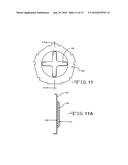 BONE CUTTER FOR CREATING HEMISPHERICAL CAVITIES diagram and image