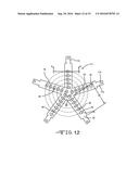 BONE CUTTER FOR CREATING HEMISPHERICAL CAVITIES diagram and image