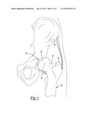 PATIENT-SPECIFIC FEMOROACETABULAR IMPINGEMENT INSTRUMENTS AND METHODS diagram and image