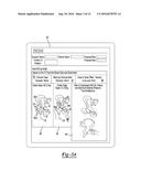 PATIENT-SPECIFIC FEMOROACETABULAR IMPINGEMENT INSTRUMENTS AND METHODS diagram and image