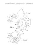 PATIENT-SPECIFIC FEMOROACETABULAR IMPINGEMENT INSTRUMENTS AND METHODS diagram and image