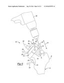 PATIENT-SPECIFIC FEMOROACETABULAR IMPINGEMENT INSTRUMENTS AND METHODS diagram and image