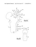 PATIENT-SPECIFIC FEMOROACETABULAR IMPINGEMENT INSTRUMENTS AND METHODS diagram and image