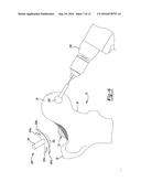 PATIENT-SPECIFIC FEMOROACETABULAR IMPINGEMENT INSTRUMENTS AND METHODS diagram and image