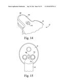 ORTHOPAEDIC SURGICAL INSTRUMENT SYSTEM FOR IMPLANTING A PROSTHETIC PATELLA     COMPONENT AND METHOD OF USE diagram and image