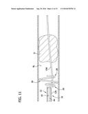 GUIDEWIRE RETRIEVAL SYSTEM diagram and image