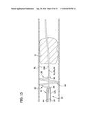 GUIDEWIRE RETRIEVAL SYSTEM diagram and image