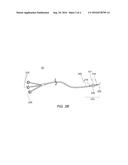 REMOVAL TOOL FOR USE WITH ENDOSCOPIC DEVICE diagram and image